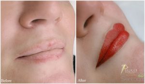 skinlogix-lips-makeup-2