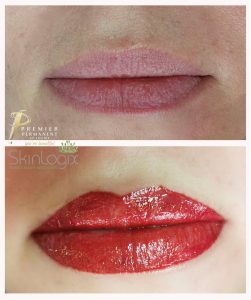 skinlogix-lips-makeup-3