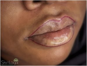 skinlogix-lips-makeup-4